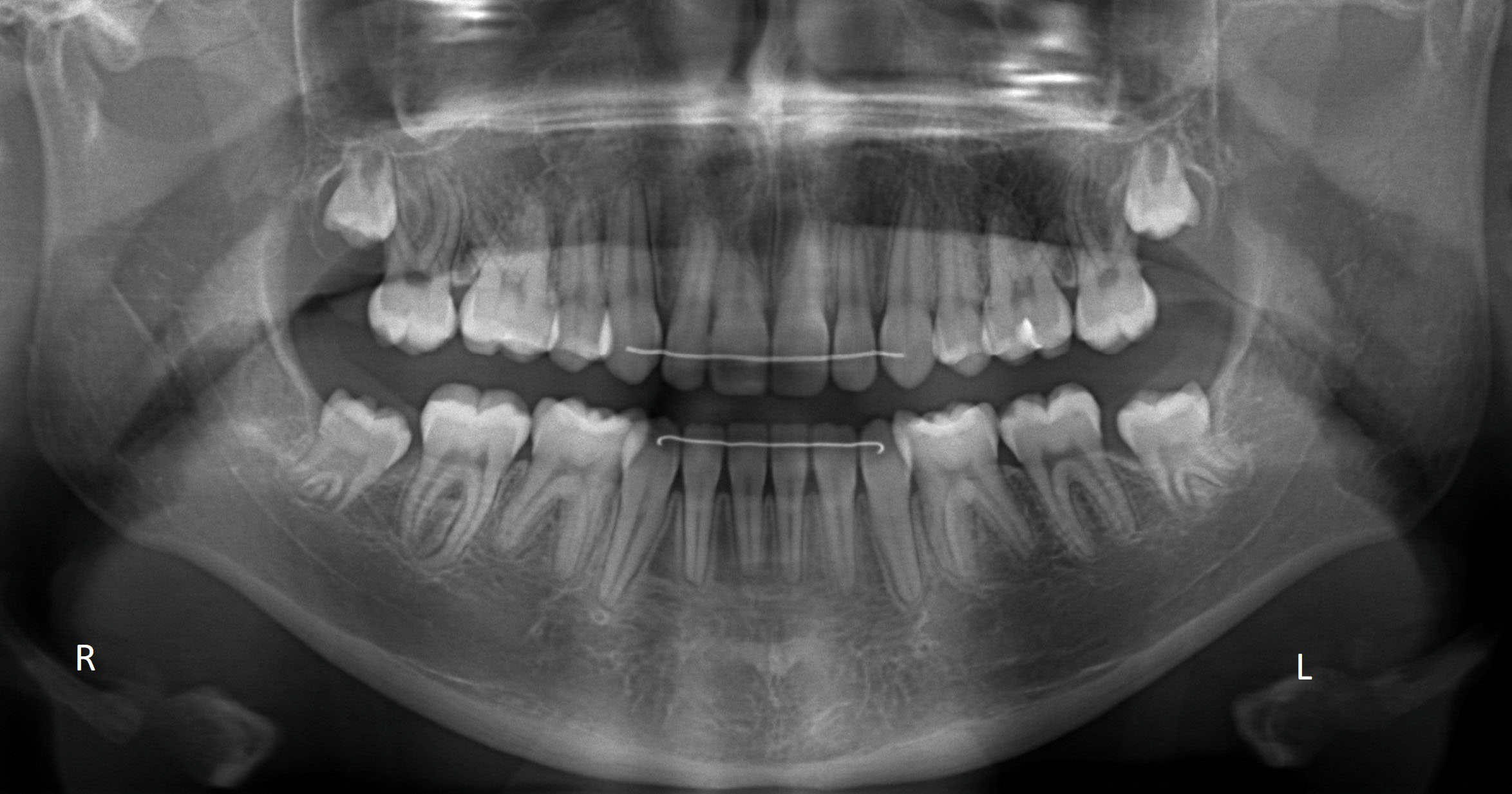 wonder buurman Aquarium Orthodontiepraktijk Binda: 'Orthodontie niet alleen voor scheve tanden' -  Barneveld Magazine